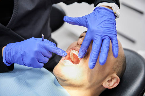 Best Emergency Dentist for Knocked-Out Tooth in Swarthmore, PA